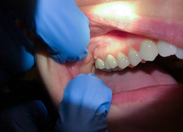 Best Orthodontic Emergency Dentist in Gower, MO