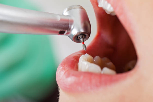 Best Weekend Emergency Dentist in Gower, MO